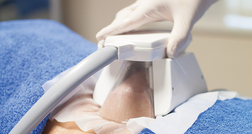 How Fat Freezing and HIFU Work Together? 2 Multiple Areas in One Session HIFU and Fat Freezing Wolverhampton