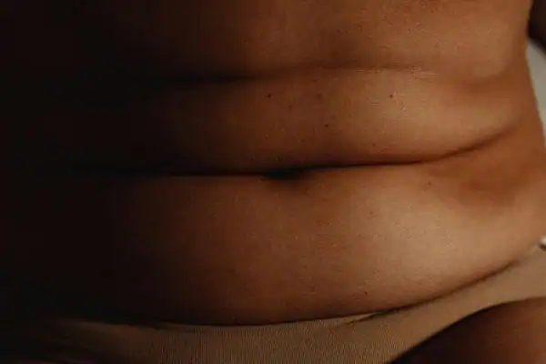 The Hidden Connection: How Stress Shapes Your Fitness and Body Composition 3 image of what stress can do on the stomach area and how Lipo 360 Wolverhampton can help to change your body shape.
